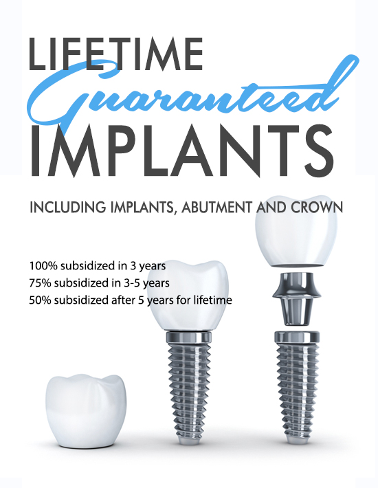 implants promotion